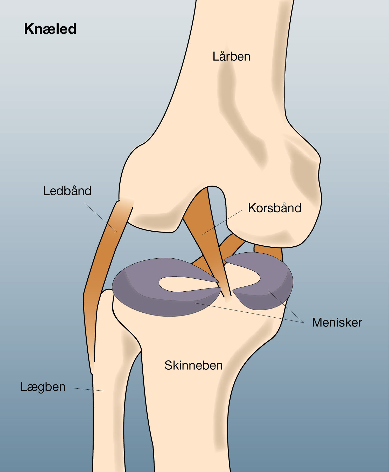 En meniskskade opstår typisk ved et vrid eller kompression af leddet så der kommer en revne i menisken